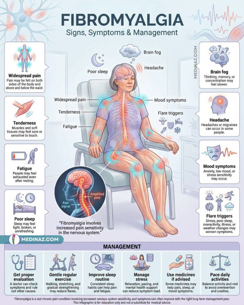 Fybromyalgie